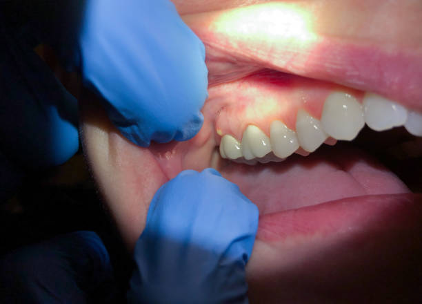 Best Emergency Dental Services Near Me  in Edburgh, IN