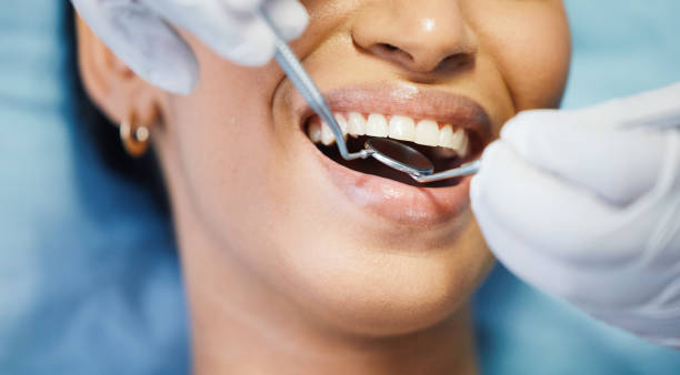 Best Knocked-Out Tooth Emergency  in Edburgh, IN